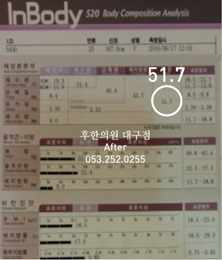 전후사진