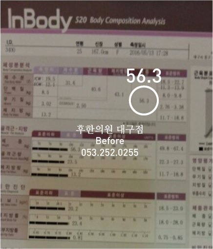 전후사진