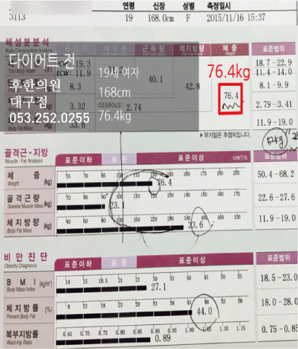 전후사진