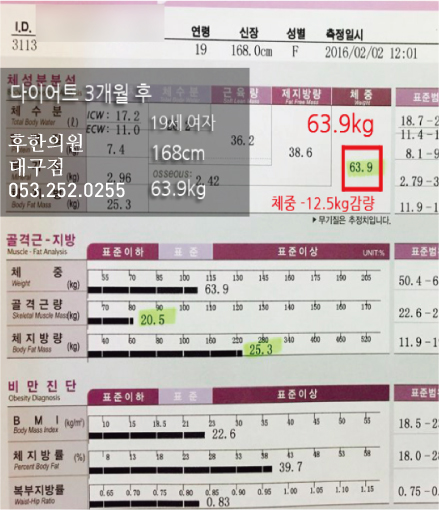 전후사진