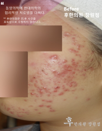 전후사진