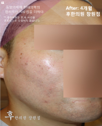 전후사진