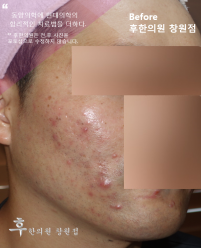 전후사진