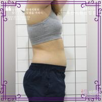 전후사진