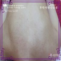 전후사진