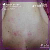 전후사진