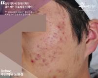 전후사진