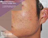 전후사진