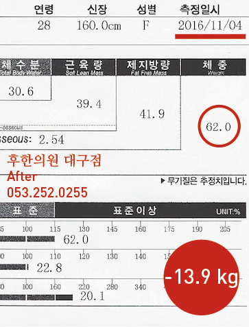 전후사진