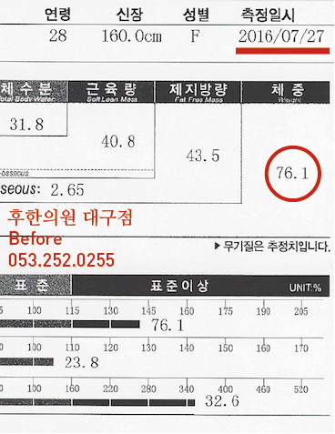 전후사진