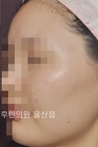 전후사진