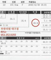 전후사진