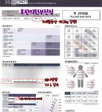 전후사진