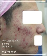 전후사진