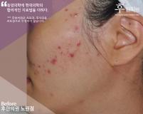 전후사진