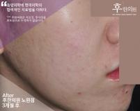 전후사진