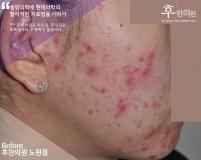 전후사진