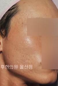 전후사진