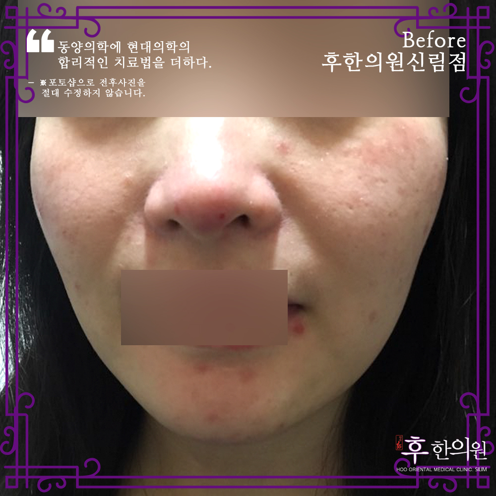 전후사진