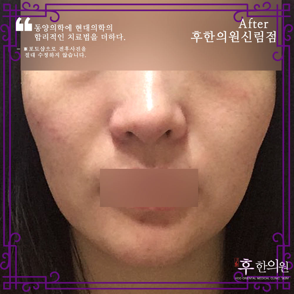 전후사진