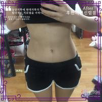 전후사진