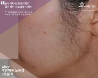 전후사진