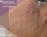 전후사진