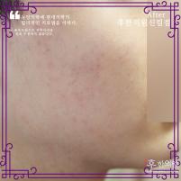 전후사진