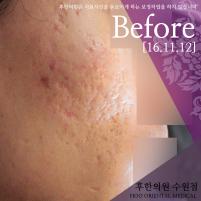 전후사진