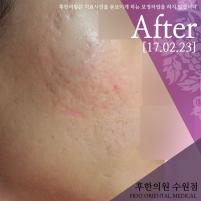 전후사진