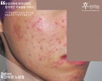전후사진
