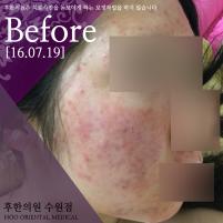 전후사진