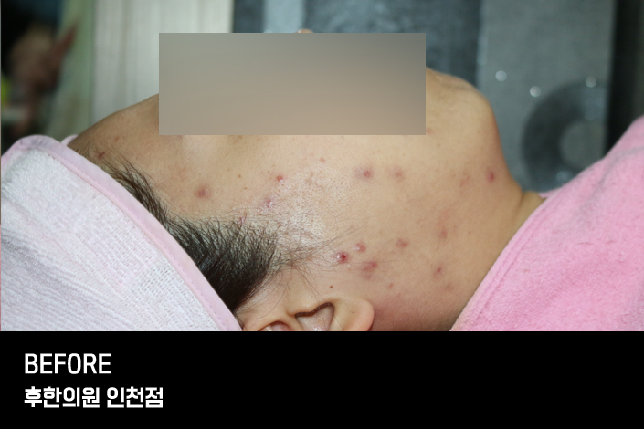 전후사진