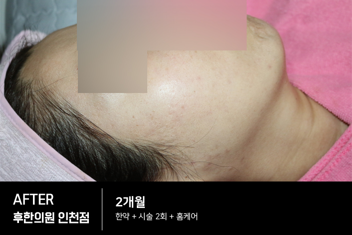 전후사진