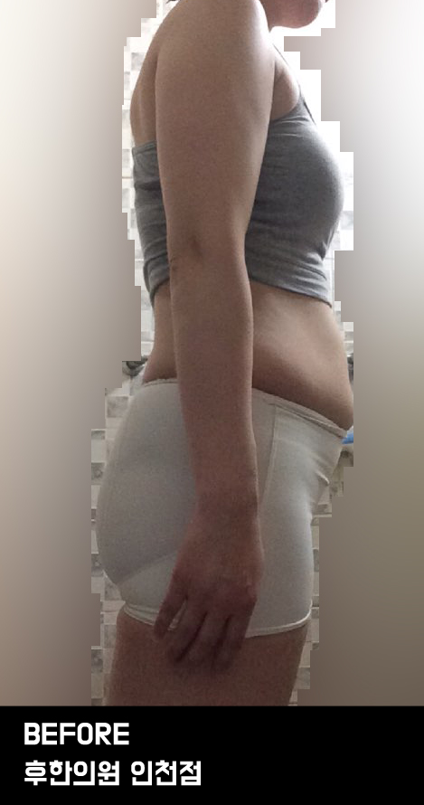 전후사진
