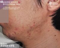 전후사진