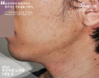 전후사진