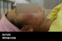 전후사진