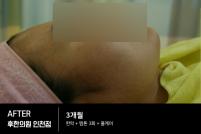 전후사진