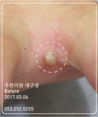 전후사진