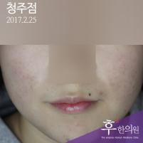 전후사진