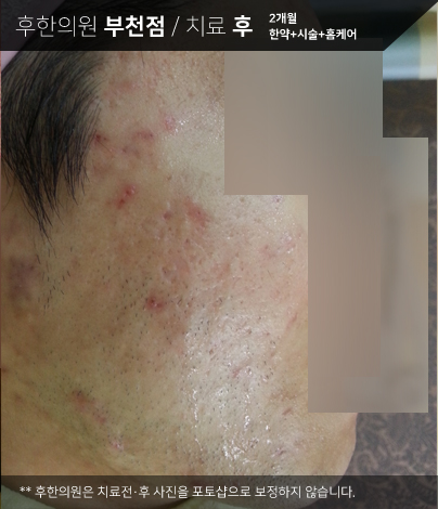 전후사진