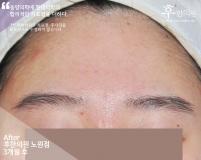 전후사진