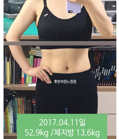 전후사진