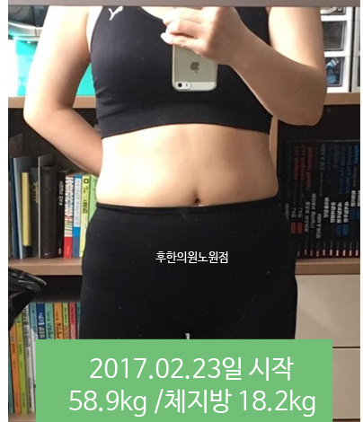 전후사진