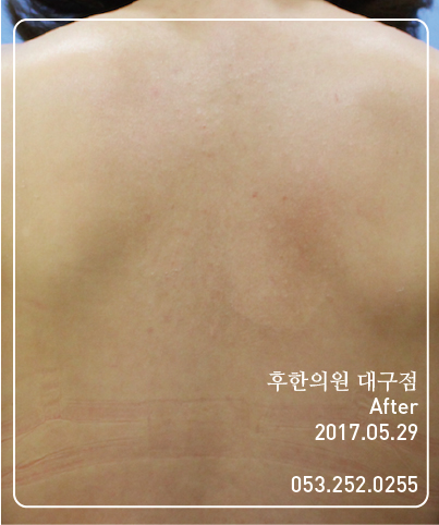 전후사진