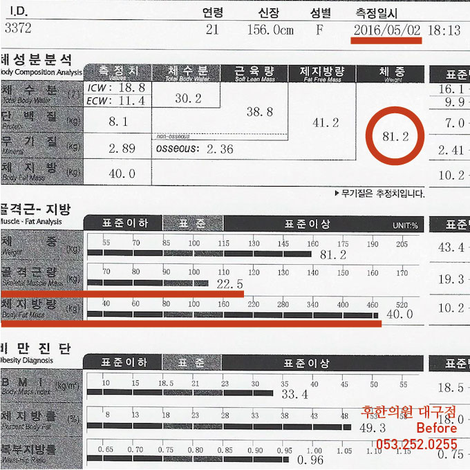 전후사진