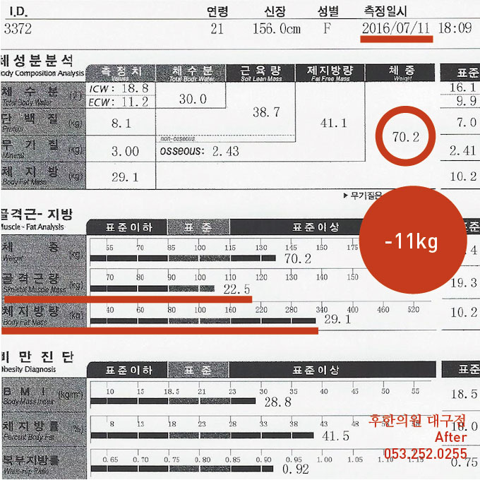 전후사진