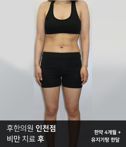 전후사진