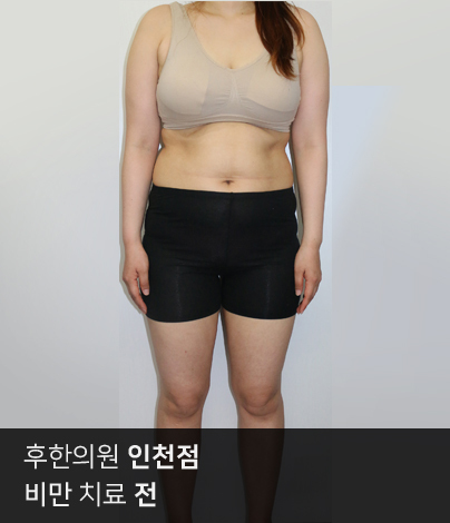 전후사진